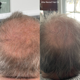 Revive7 Revitalizing Hair Treatment