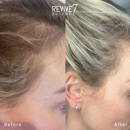 Revive7 Hair Treatment